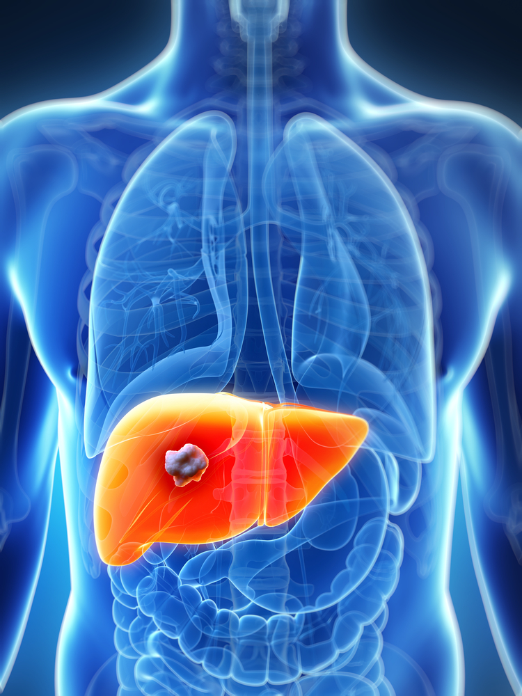 New Drug Shows Promise In Treating Chronic HCV Patients With Liver Transplant And Advanced Liver Disease