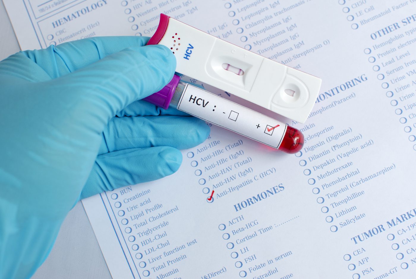 Promising Early Data Reported for Hepatitis C Investigational Drug.